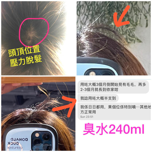 Twinsutol Herbal Hair Serum （240ml）子子蓮草本養護髮臭水（240ml）